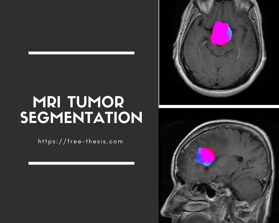 Brain Tumor Segmentation in MRI Images