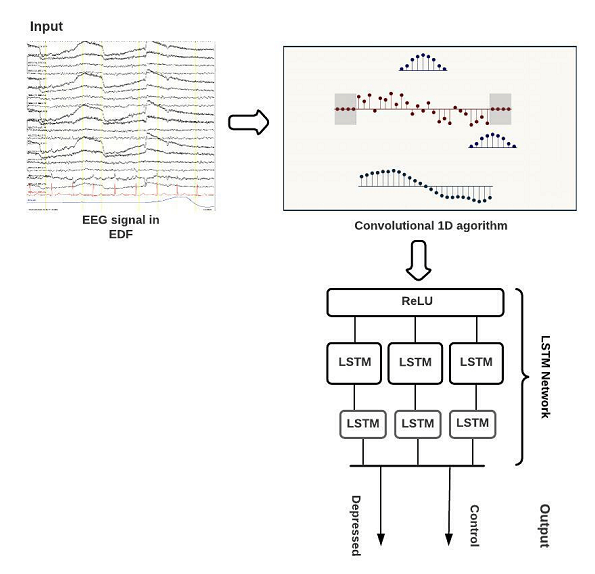 The complete designed model for primarily screening of depression based on EEG-free-thesis